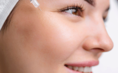 Botox em Santo André: Quando Fazer e Como Manter Natural