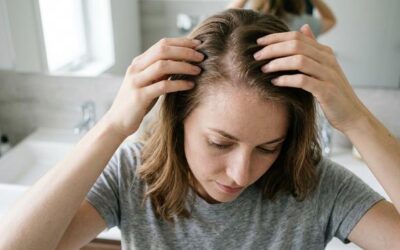 Queda de cabelo e alopecia em Santo André: quando procurar dermatologista?